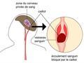 Lire l'article